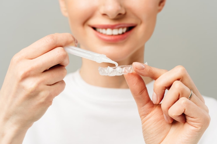 Brighten Your Smile: Teeth Whitening in Stafford
