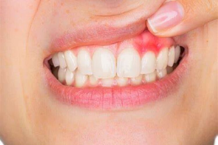 Blog - Church Lane Dental