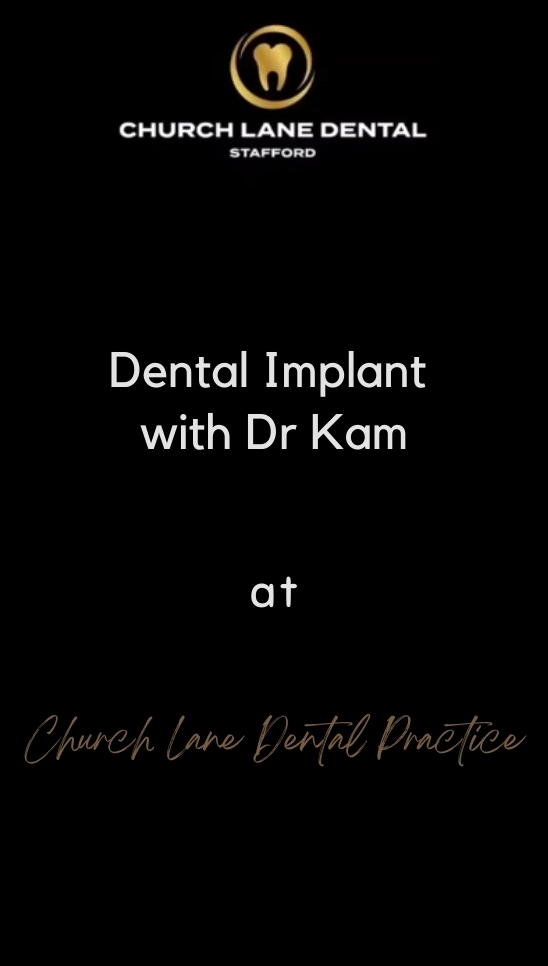 Implants with Dr Kam
