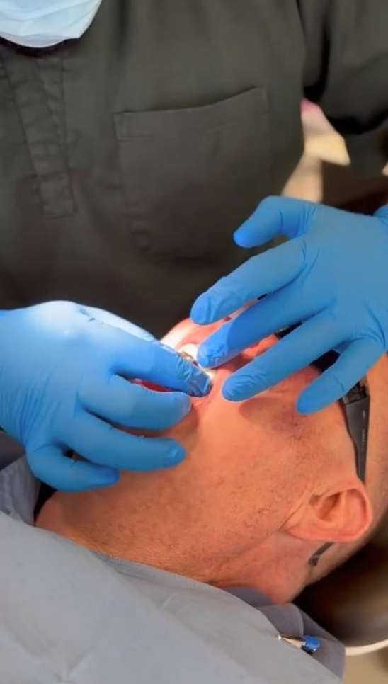 Dental implants case