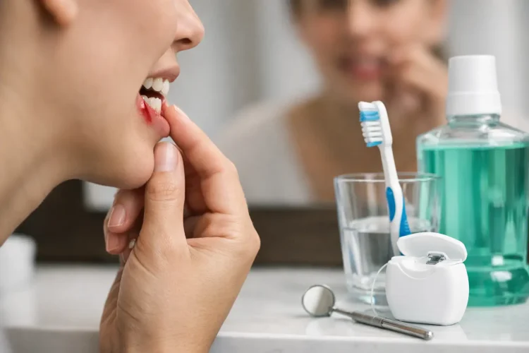 How to Treat Bleeding Gums: What Works Now